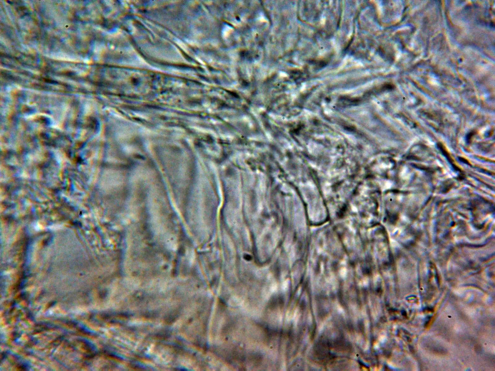 Microscopía de Tephrocybe atrata - 10 - Suprapellis agua 4
